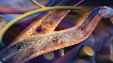 Установка BeGraft