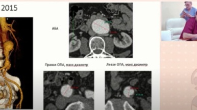 Установка BeGraft