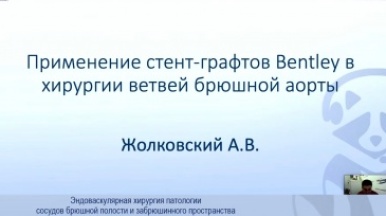 Применение стент-графтов Bentley в хирургии ветвей брюшной аорты - А.В. Жолковский